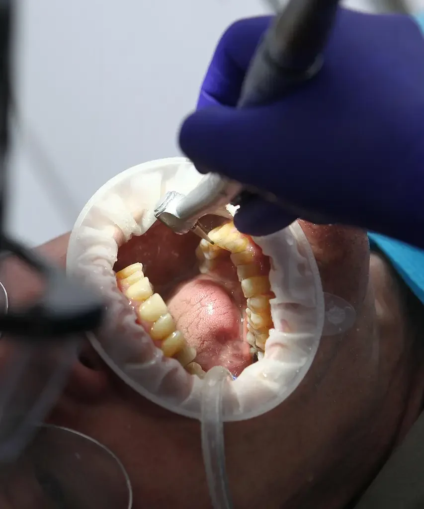 ترمیم دندان